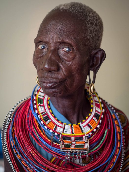 Fundación Elena Barraquer  -Kenia- País Samburu